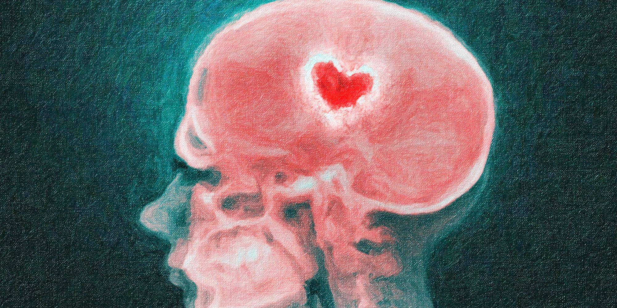 ¿cómo Funciona El Cerebro Cuando Nos Enamoramos Cidics Uanlemk 5573