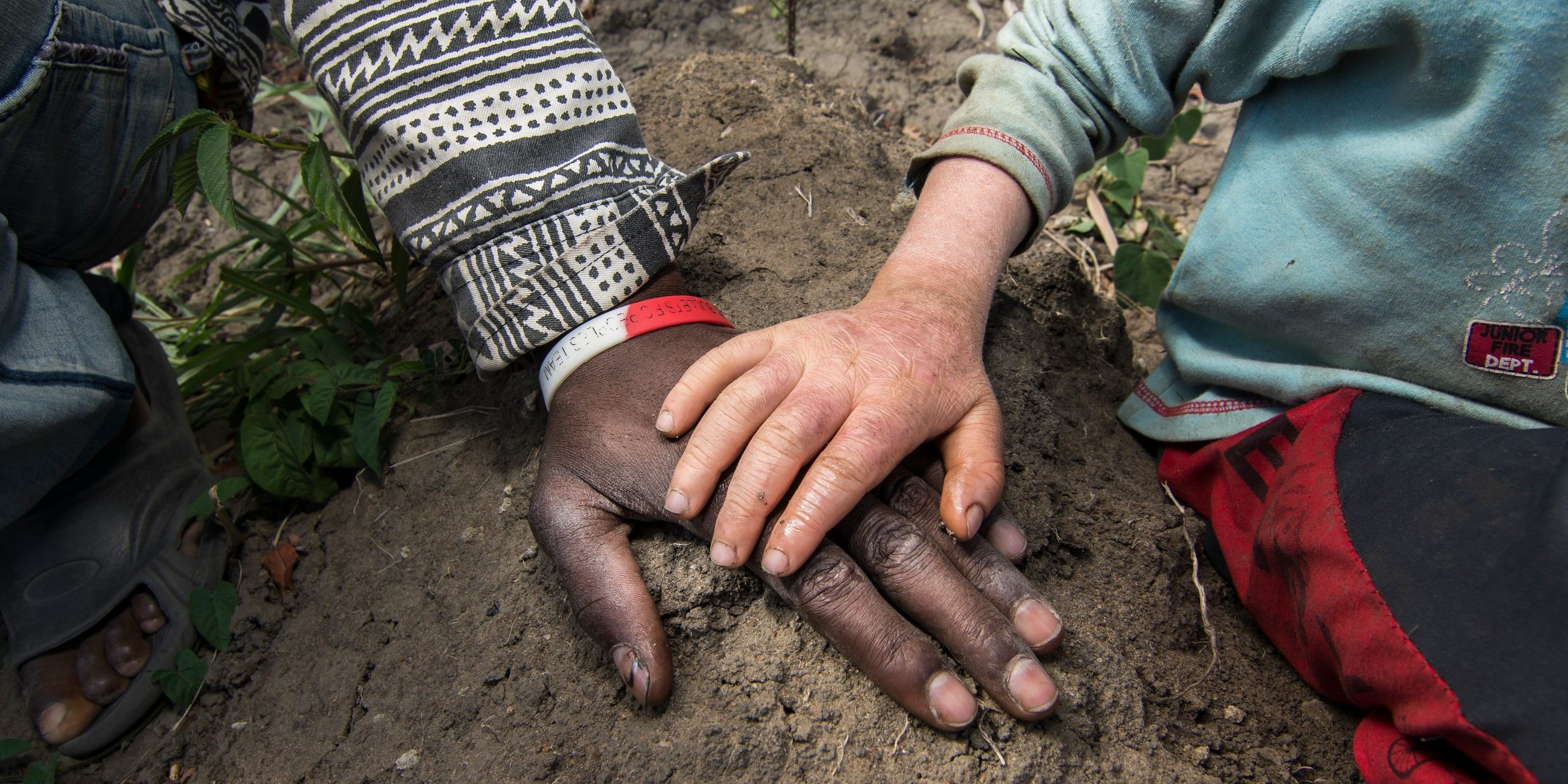 People with albinism in South Africa suffer from stigmatization – CIDICS –  UANL